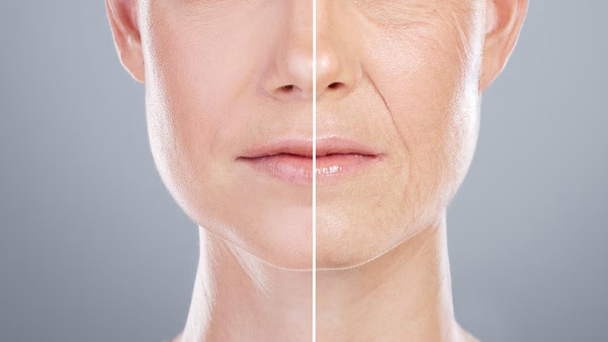 fine-lines-and-wrinkles