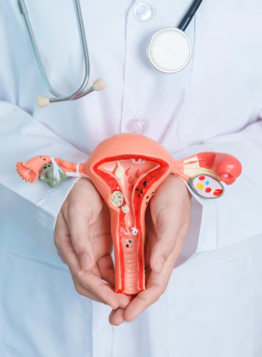 uterine-fibroids