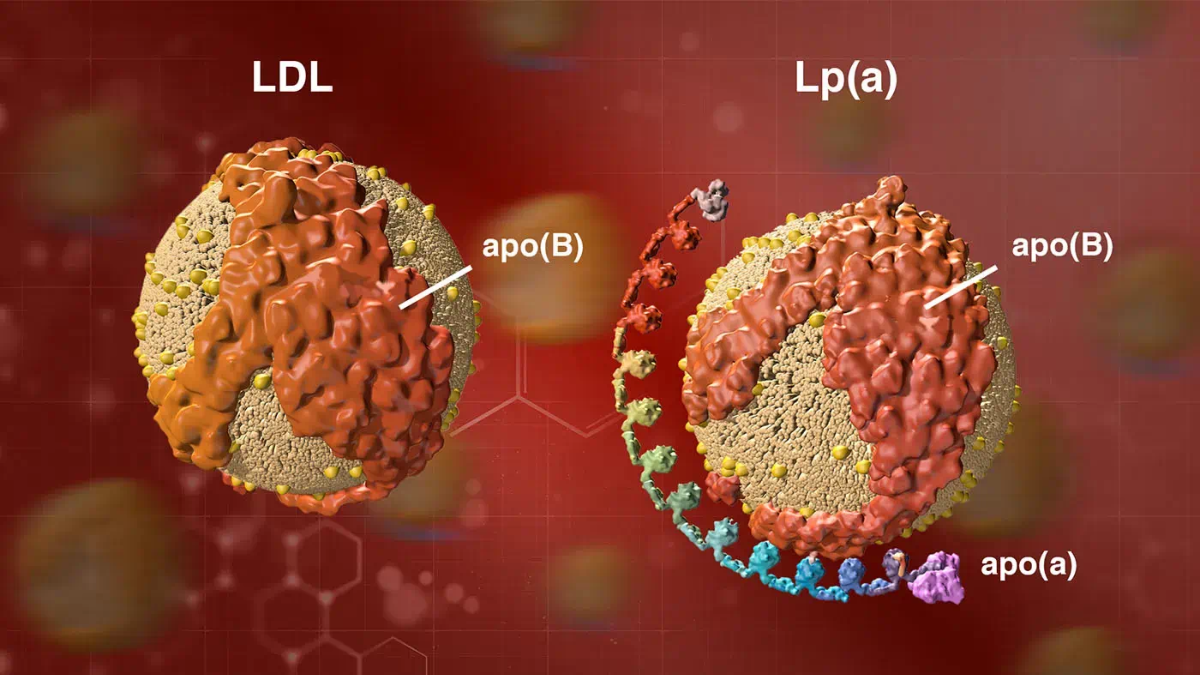 Lipoprotein(a) Linked to Heart Disease and Stroke Across Asia and Europe, Study Finds