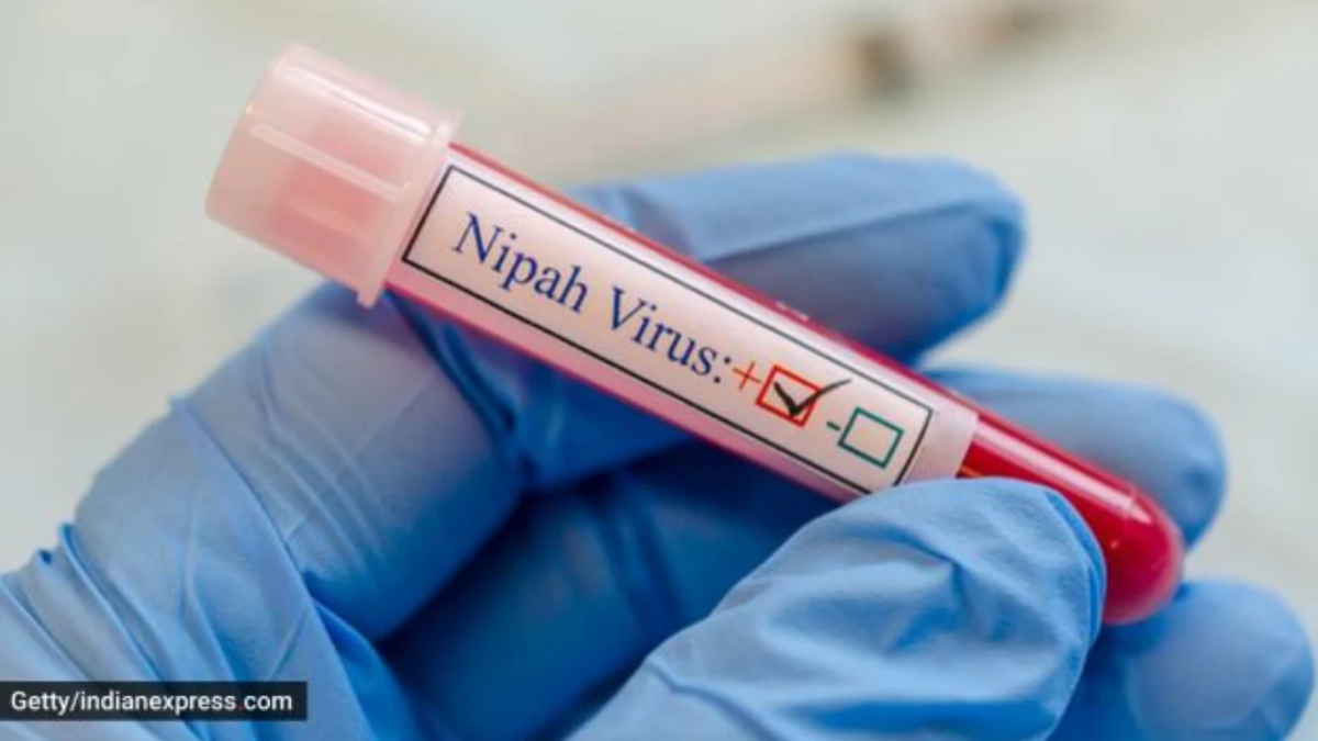 02-nipah-virus