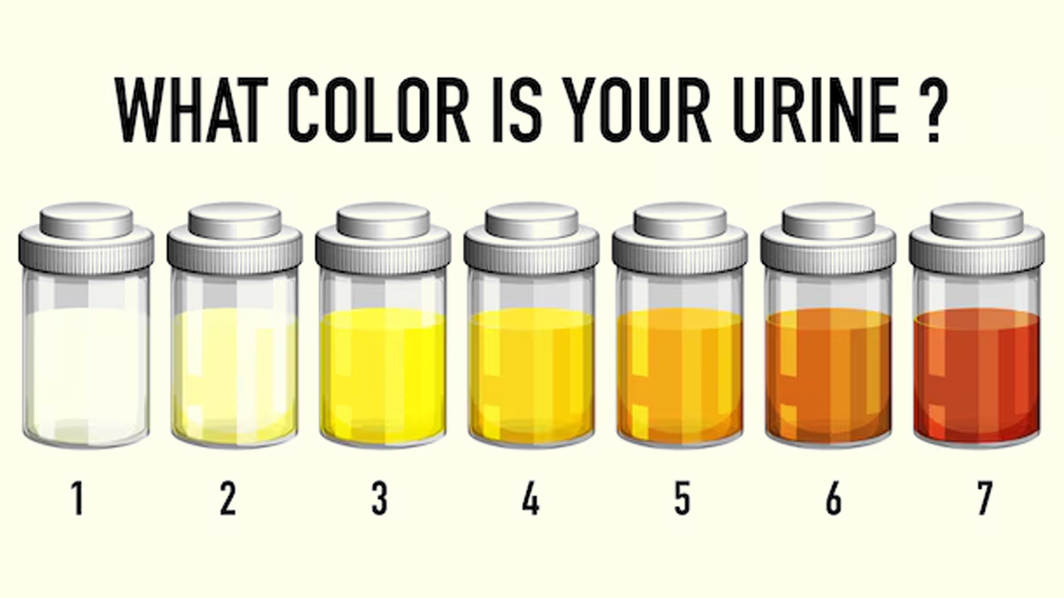 changes-in-urine-colour