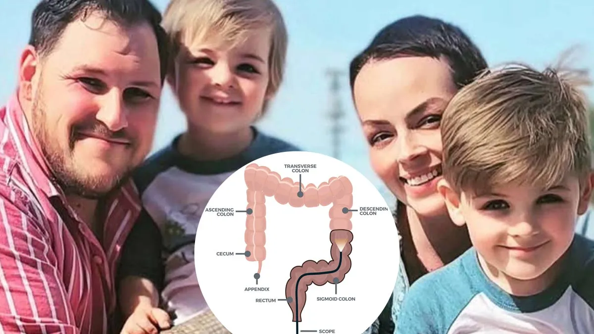 Denied Colonoscopy at 36, Mom of Two from New York Gets Stage 4 Colon Cancer: What Is the Right Time to Get Screened?