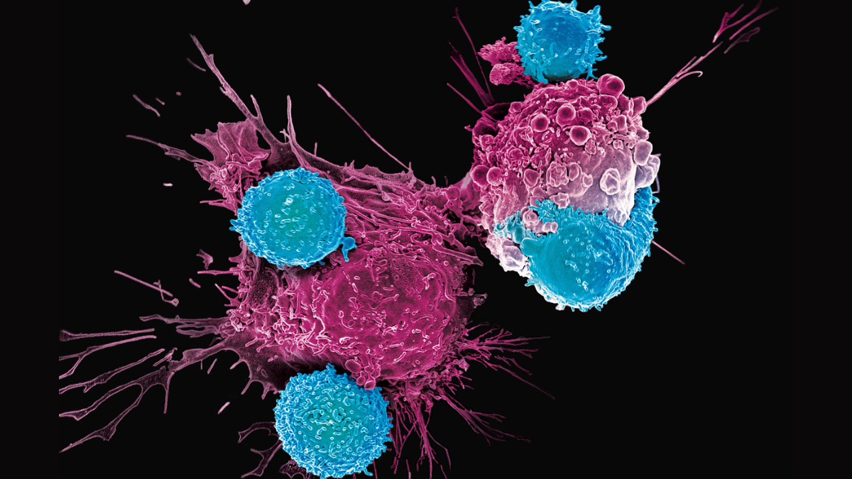 Game-Changing CAR-T Cancer Therapy Linked To ‘Brain Fog,’ Study Warns Of Cognitive Side Effects