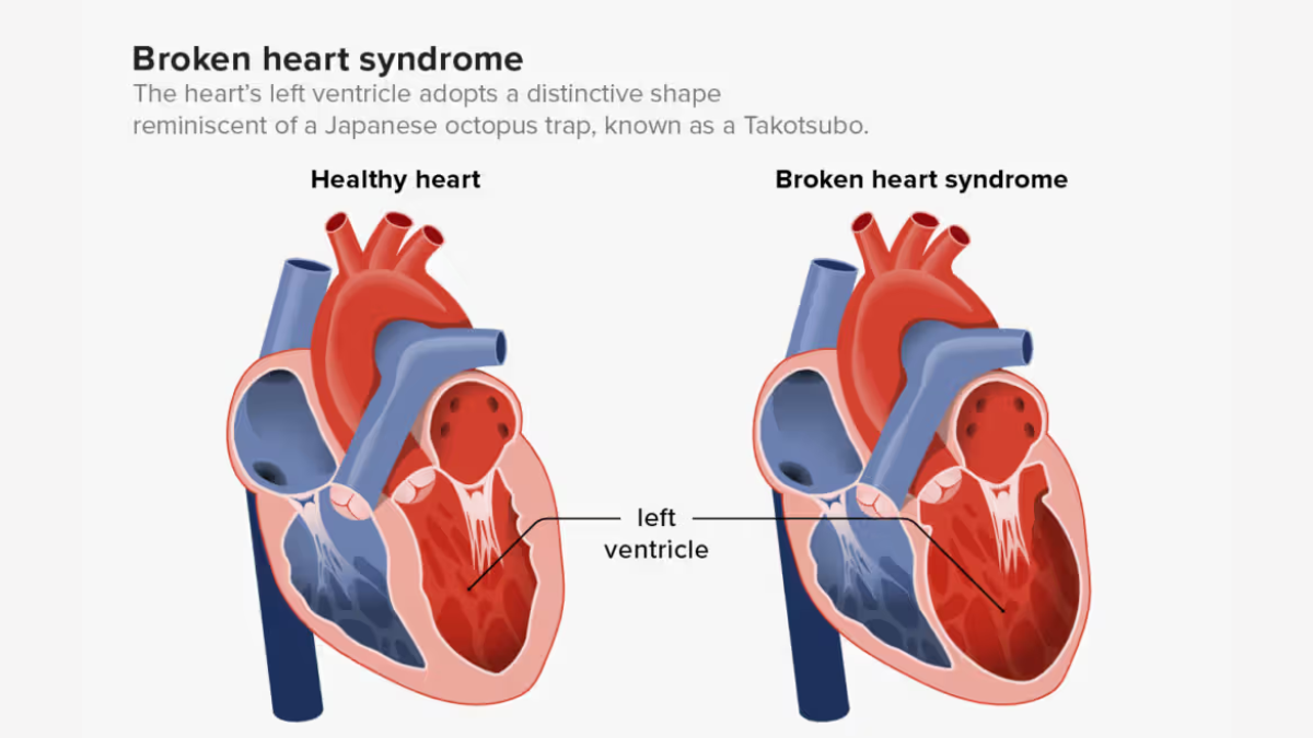 02-broken-heart