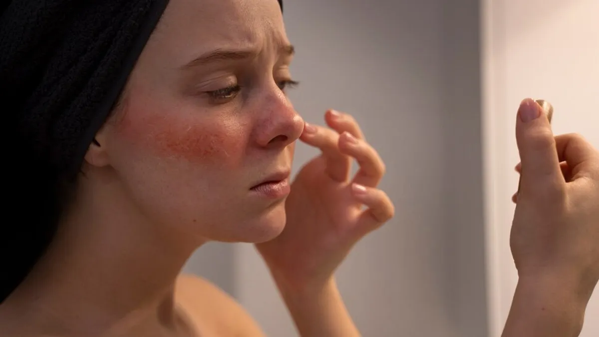 What Does Skin Poisoning Look Like? Expert Shares How To Stay Safe!