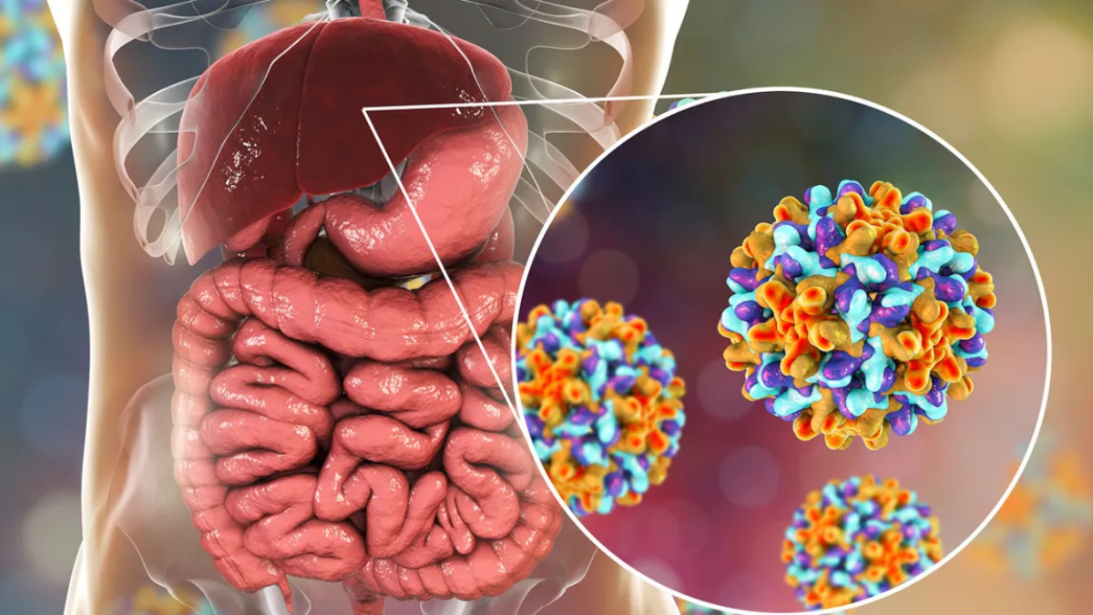 Hepatitis Testing Day 2025: What Is The Difference Between Hepatitis B And Jaundice?