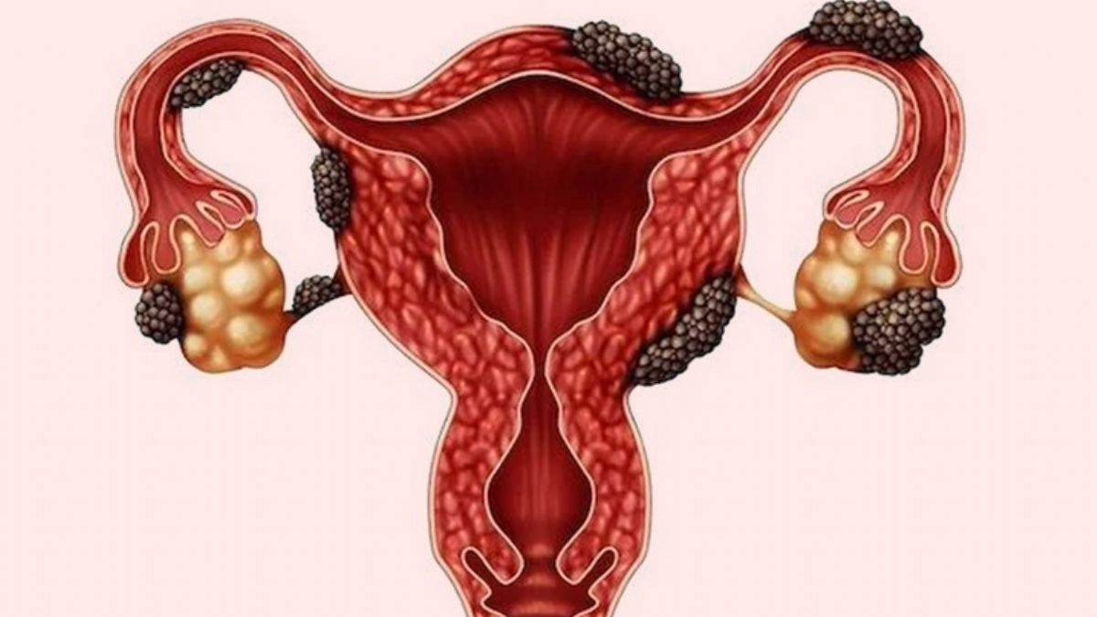 2 - 2025-05-19T132046.813