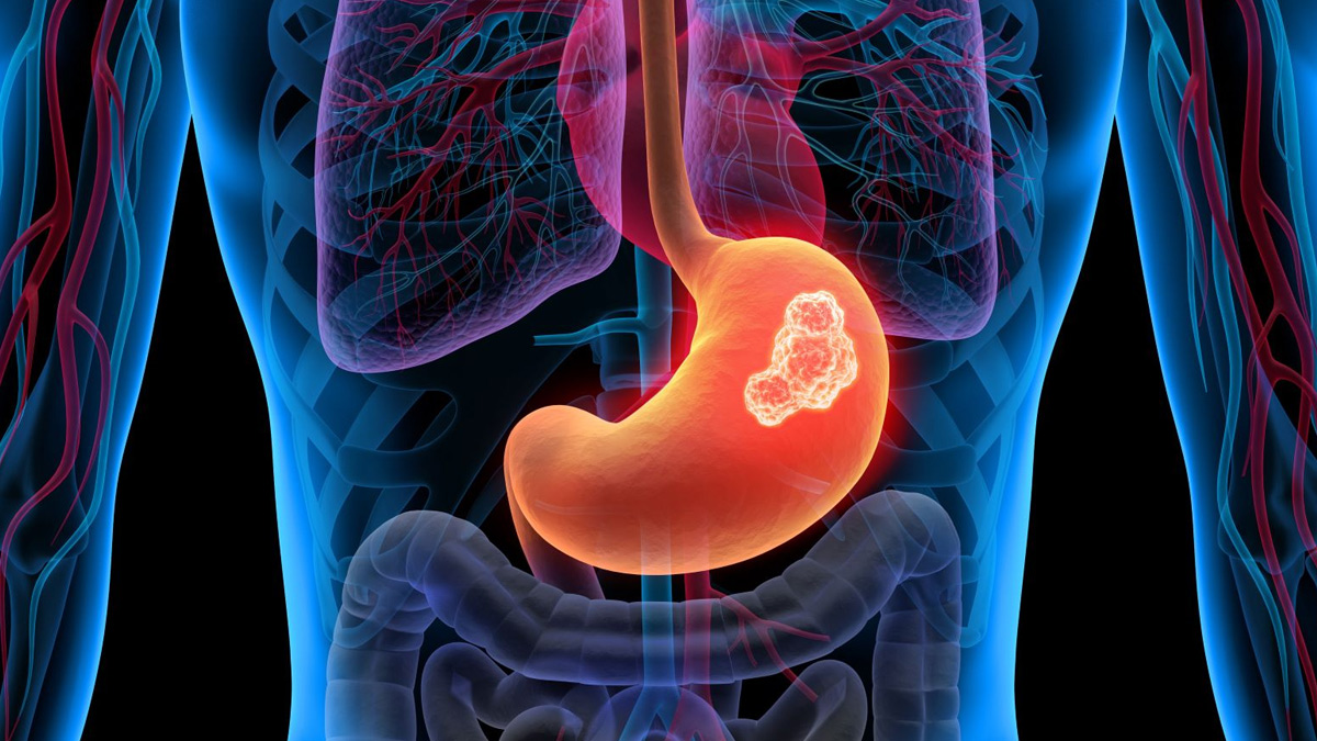 3 - 2025-05-20T161243.944