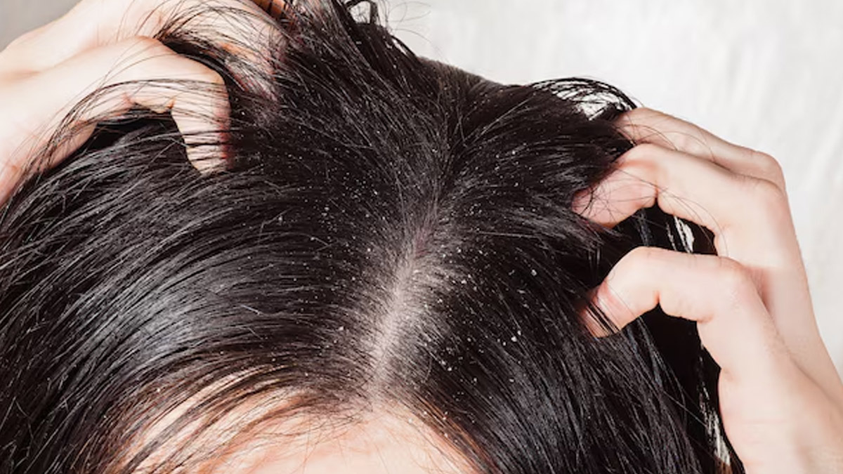 oily-hair