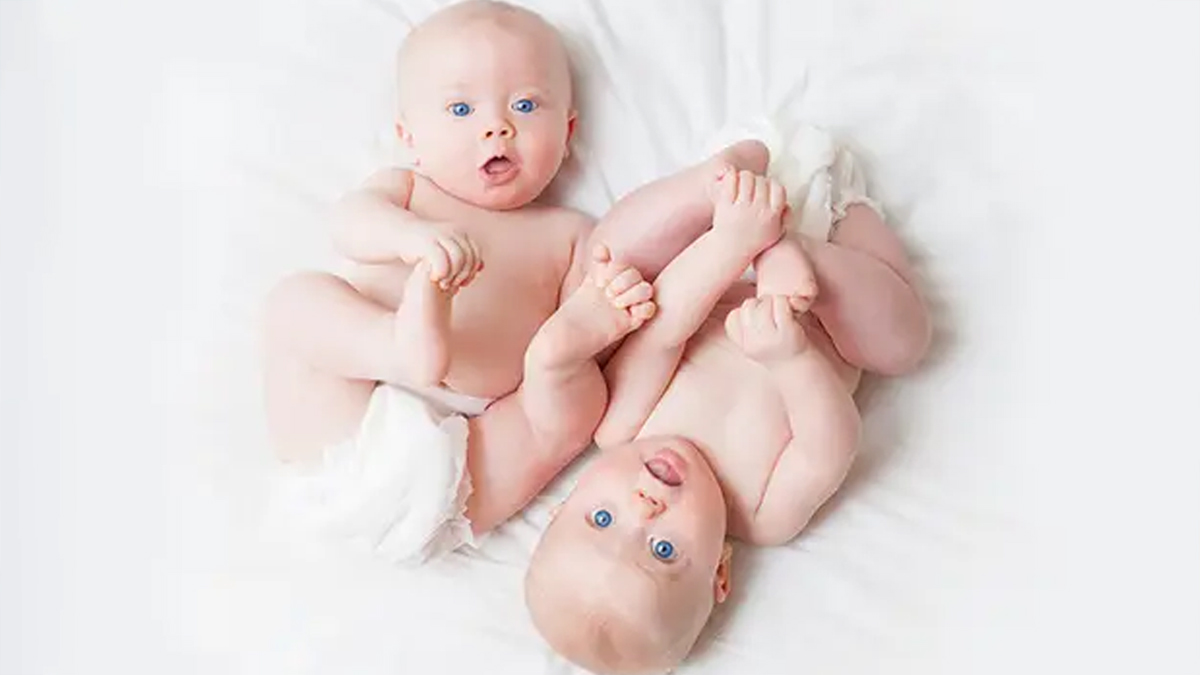 Monochorionic Diamniotic Twins delivery 3 - 2025-05-21T134501.045