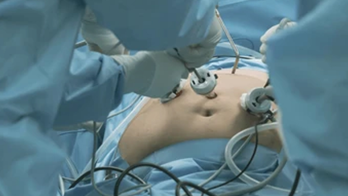 bariatric-surgery