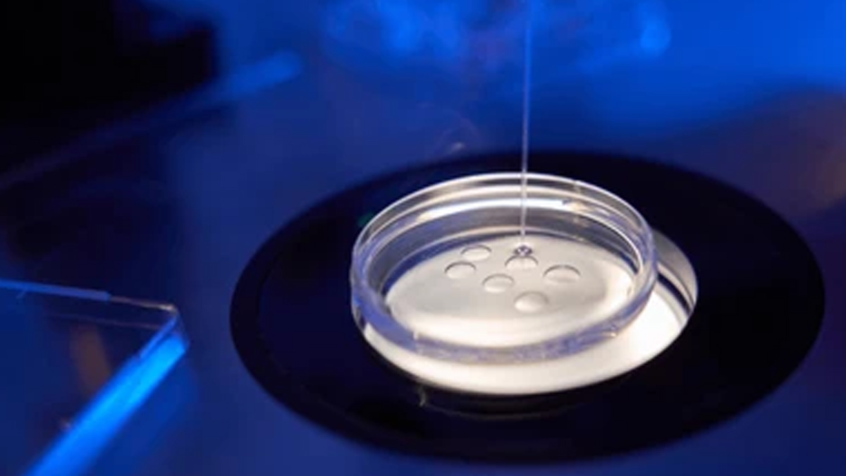egg-freezing