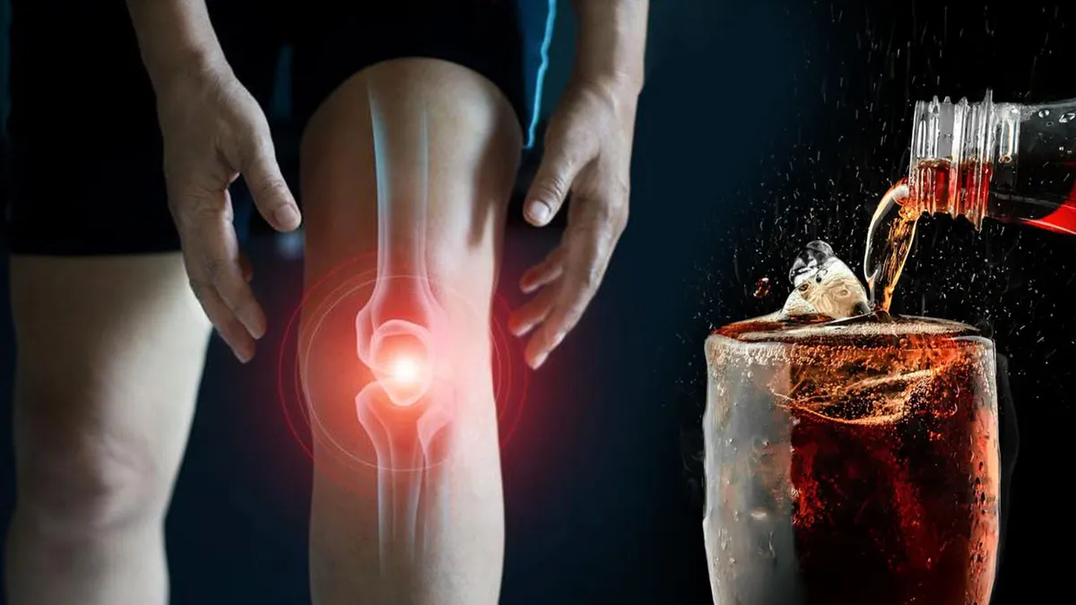 Do Cold Drinks Really Harm Your Bones? Expert Shares The Impact of Soft Drinks