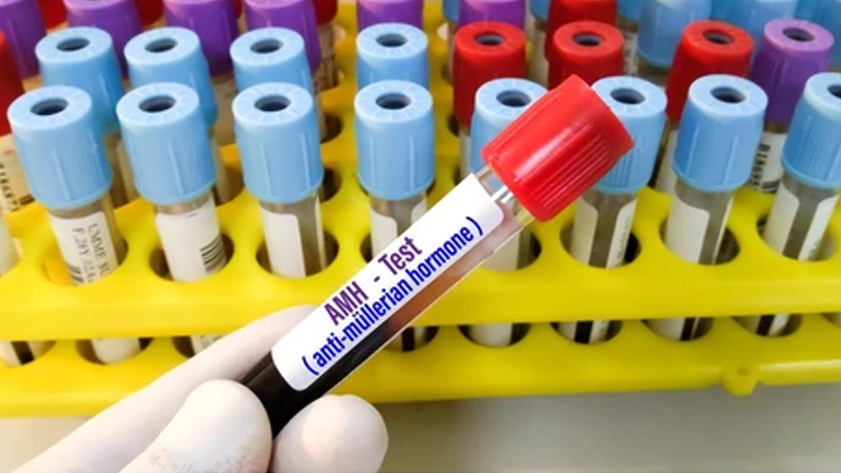 Anti-Müllerian-Hormon- test