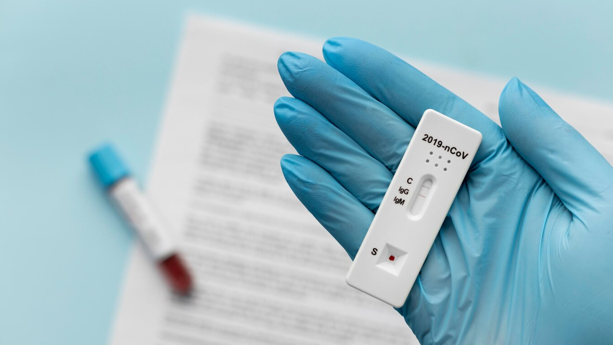 Rapid-antigen-test
