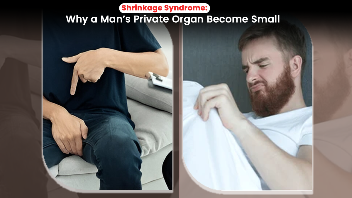 What is Shrinkage Syndrome? Reasons Why a Man’s Private Organ May Become Small