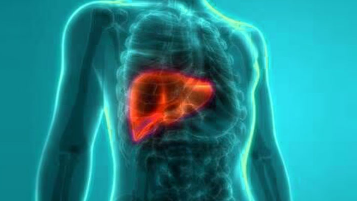 Beat Fatty Liver: Nutritionist Recommends Top 5 Foods To Detox And Melt Liver Fat Naturally