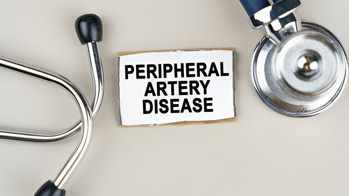 Peripheral-artery-disease