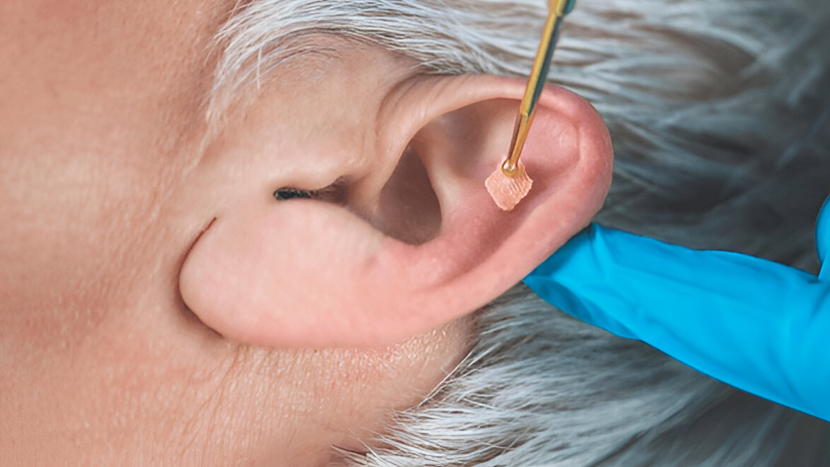 ear-seeds