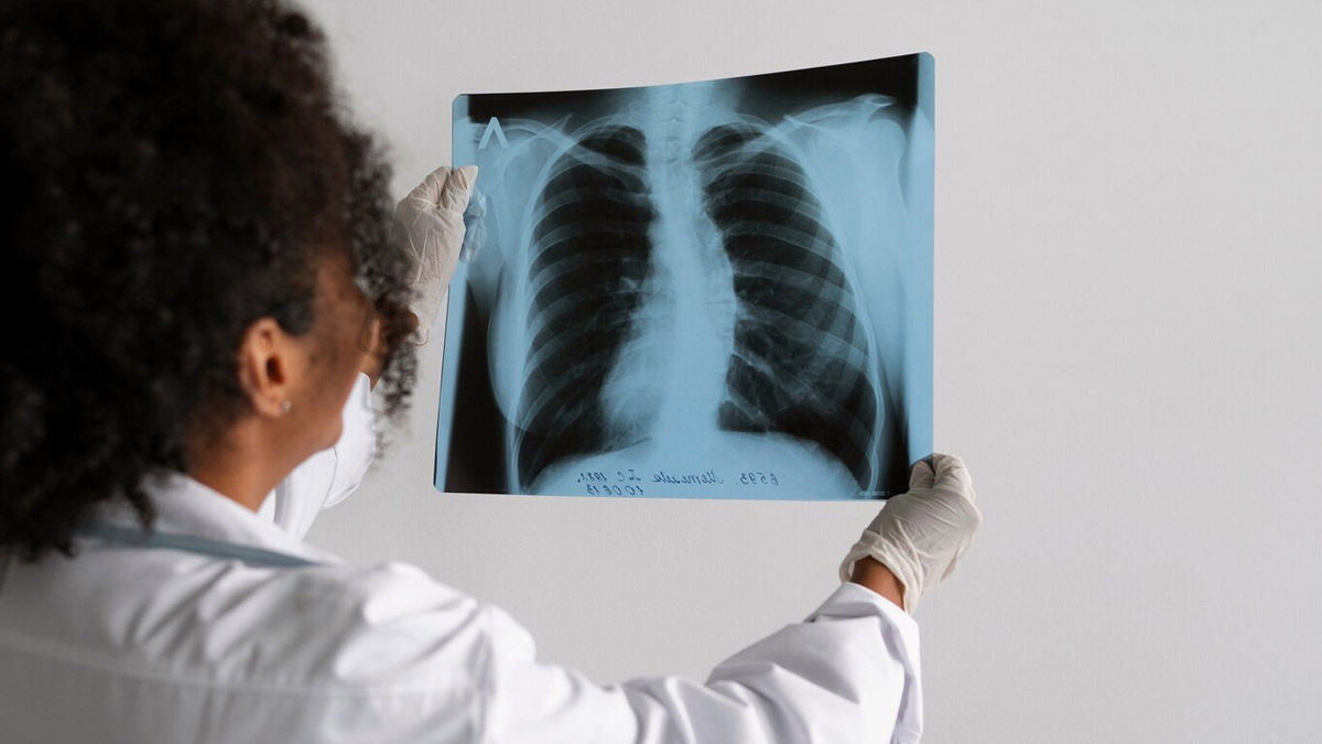 Why Lung Cancer Is Not Just A Smoker's Disease: Risk Factors To Note