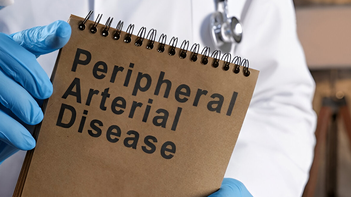 peripheral-artery-disease