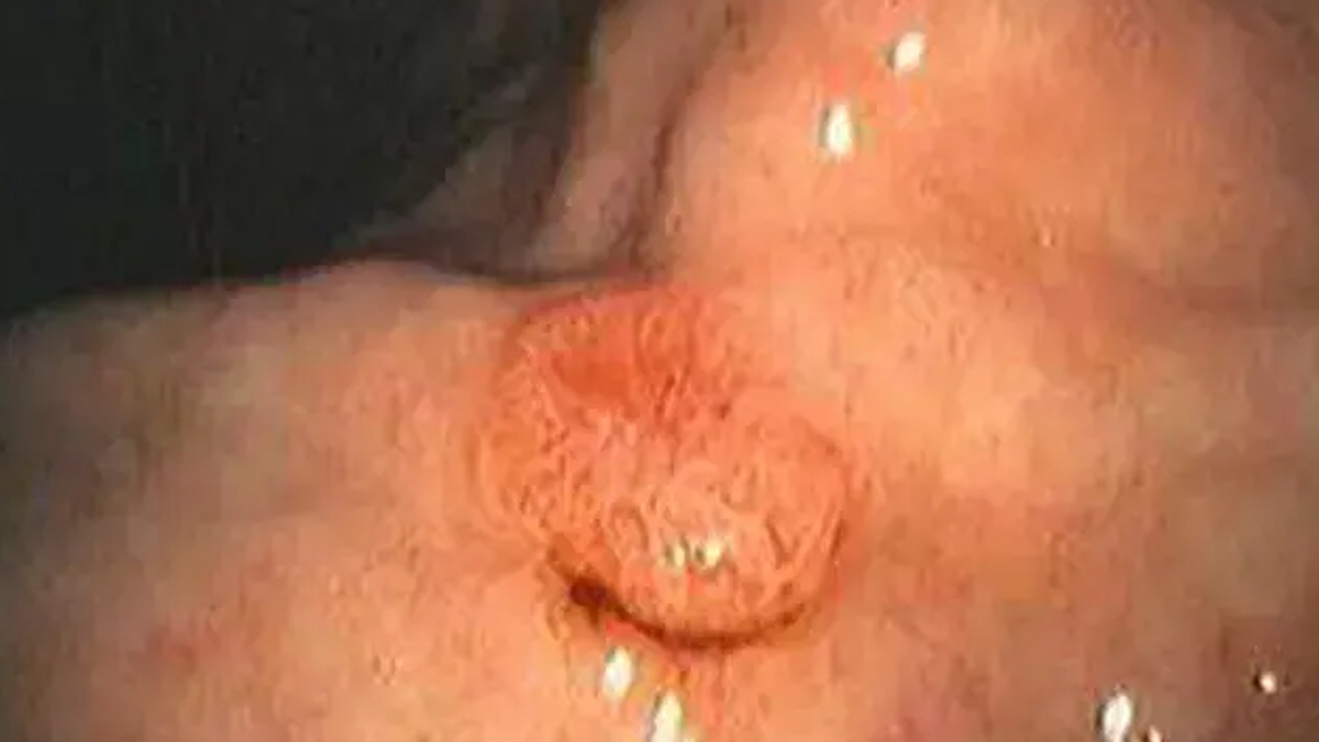 Vibhu Raghave Cause of Death Stage 4 Neuroendocrine Colon Cancer 1 - 2025-06-03T124427.974