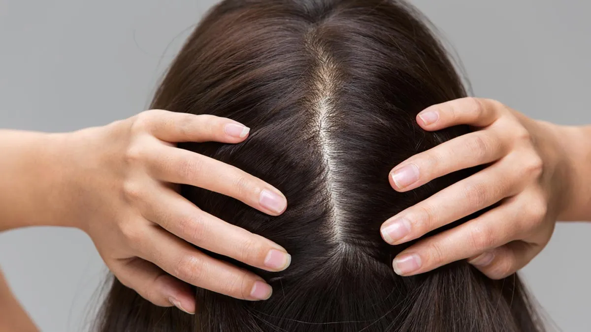 How To Control Oily Build Up On Scalp? Expert Shares