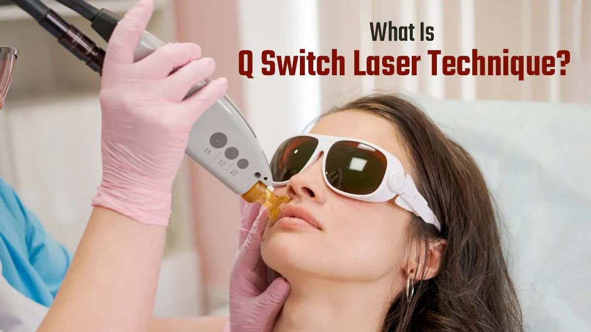 Uneven Skin Tone and Pigmentation? Here’s How Q-Switch Laser Can Transform Your Skin
