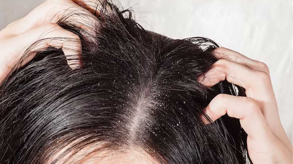 1-hair