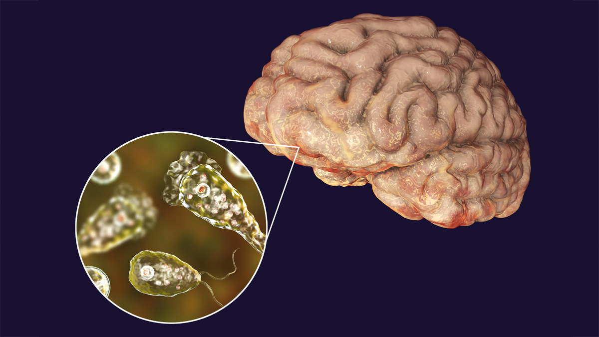 Brain-Eating Amoeba Naegleria fowleri 2 - 2025-06-04T115459.037