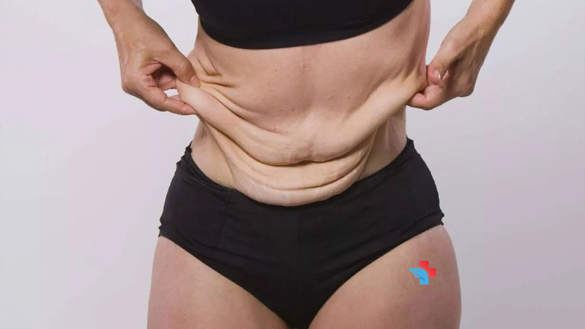 skin removal surgery 3 - 2025-06-04T110412.770