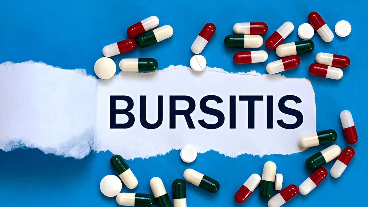 bursitis