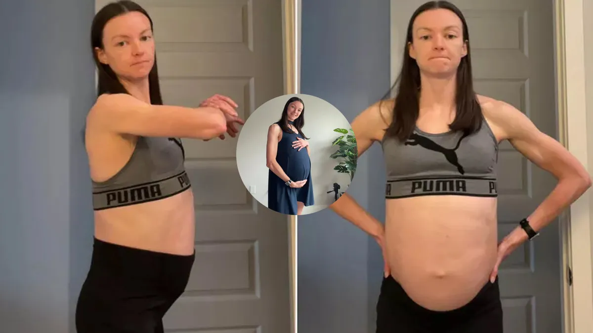 Fitness Trainer Avoids Doctors for 7 Years, Discovers Baby-Sized Cyst After Social Media Intervention