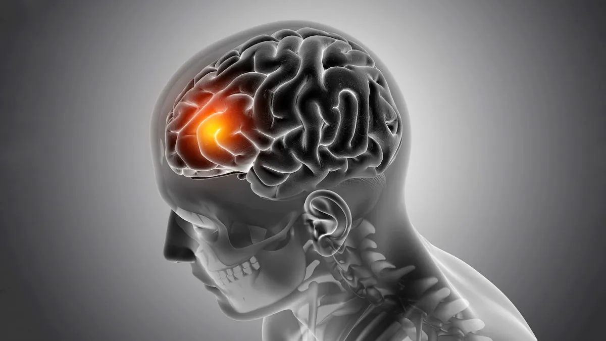 Brain Tumours On A Rise In India: Expert Reveals Types Of People Who Are Most Susceptible