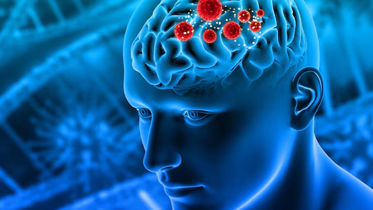 A Neurologist Shares 5 Things Stroke Patients Should Never Do