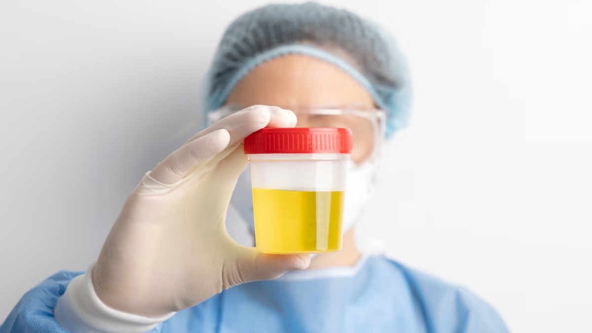urine-infection