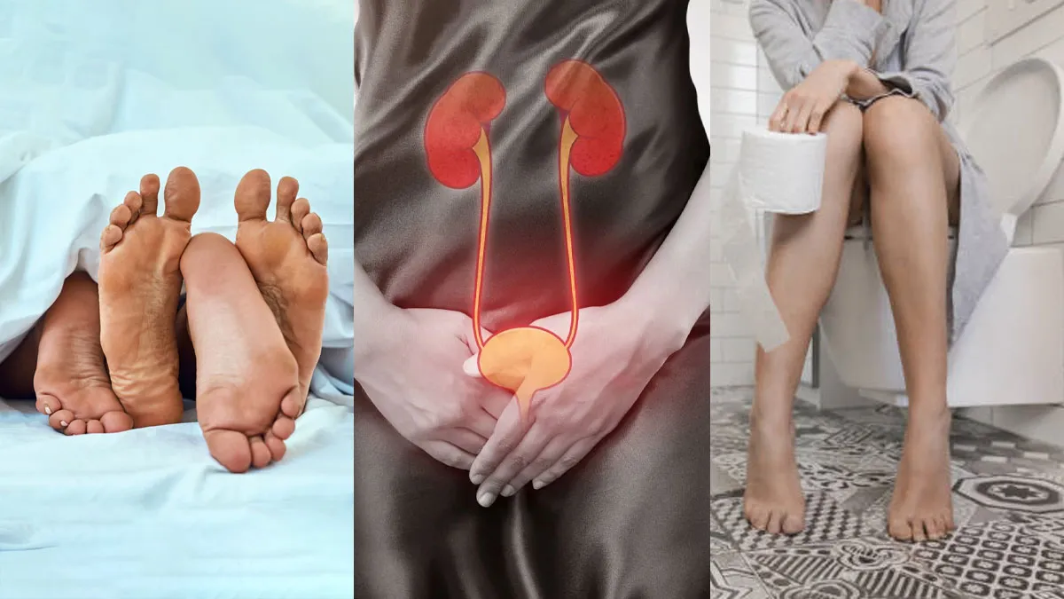 Can Peeing After Sex Stop UTIs? What Science Says About This Common Advice