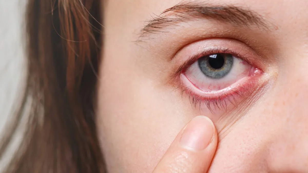What To Do If Your Contact Lens Gets Stuck in Your Eye