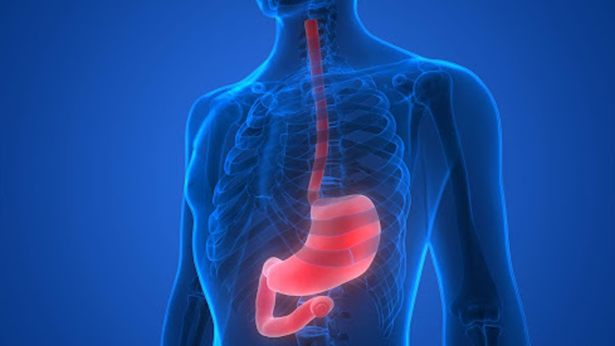 3 - 2025-06-13T113340.446