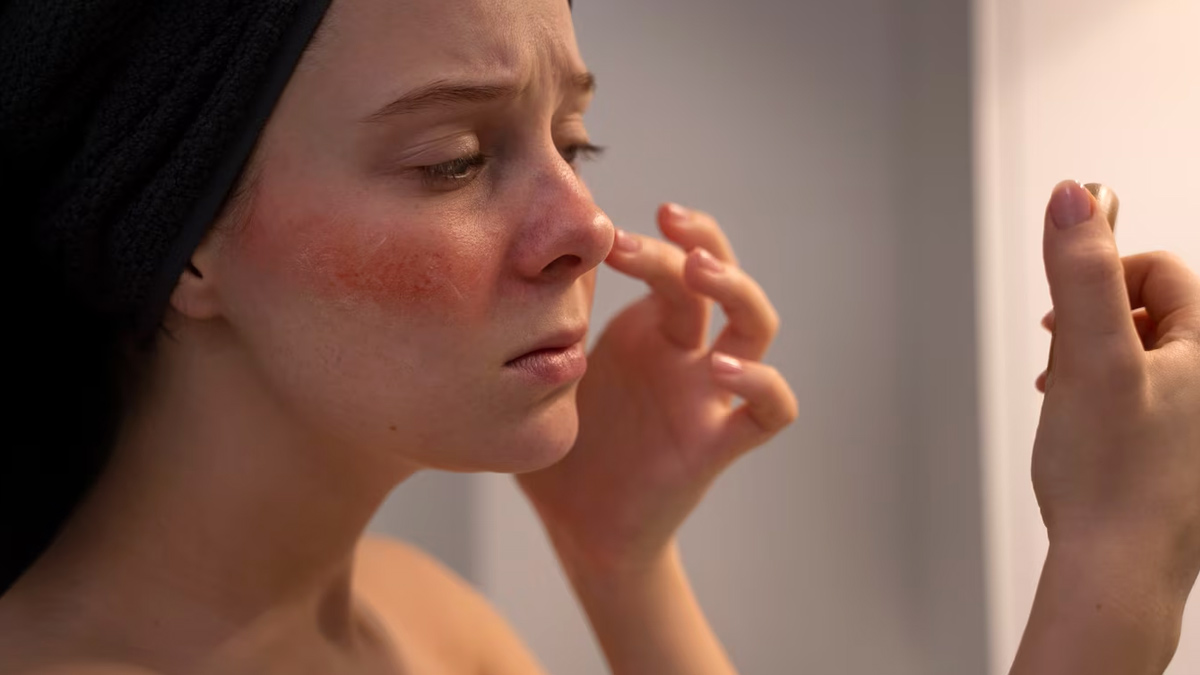 skin-redness