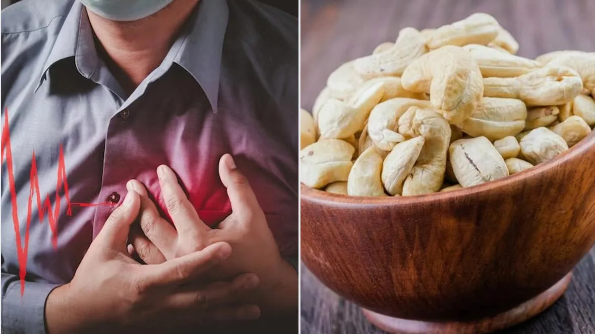 Do Cashew Nuts Raise Cholesterol? Expert Debunk the Myths and Reveal Side Effects

