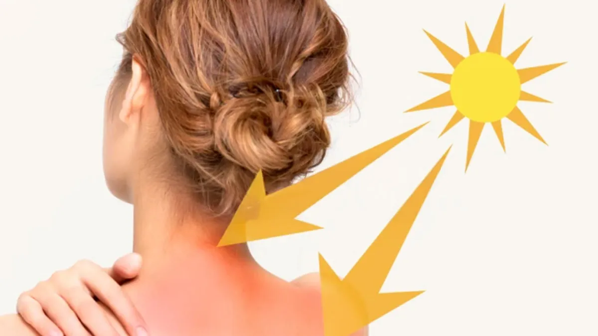 Back-Of-The-Neck Tan: How To Even It Out Without Bleaching