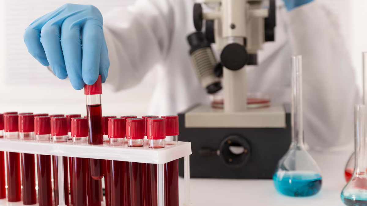 Can A Simple Blood Test Predict Your Lifespan? Study Answers
