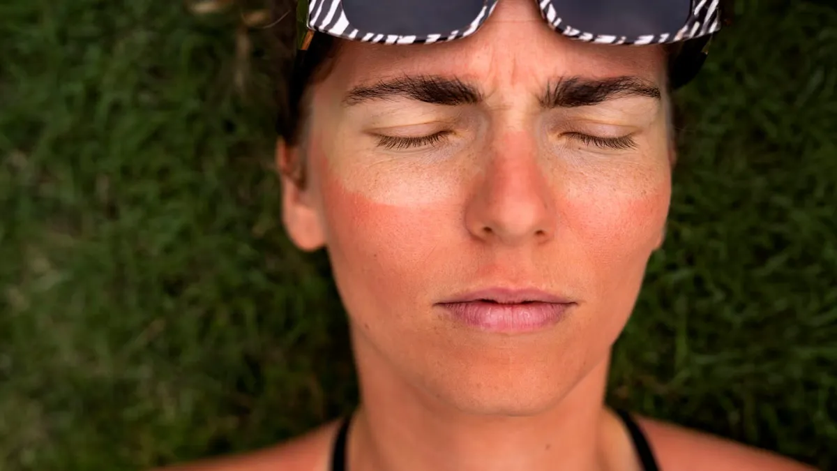 How To Make A Post-Sun Recovery Face Pack That Doesn’t Burn Your Skin Barrier
