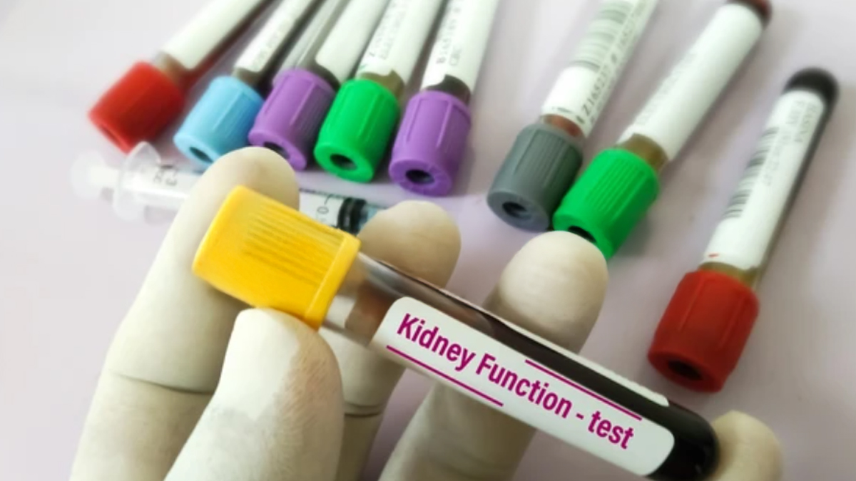 kidney-function-test