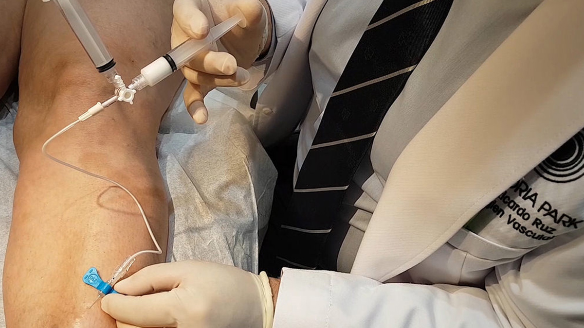 Sclerotherapy for veins 3 - 2025-06-20T133254.120