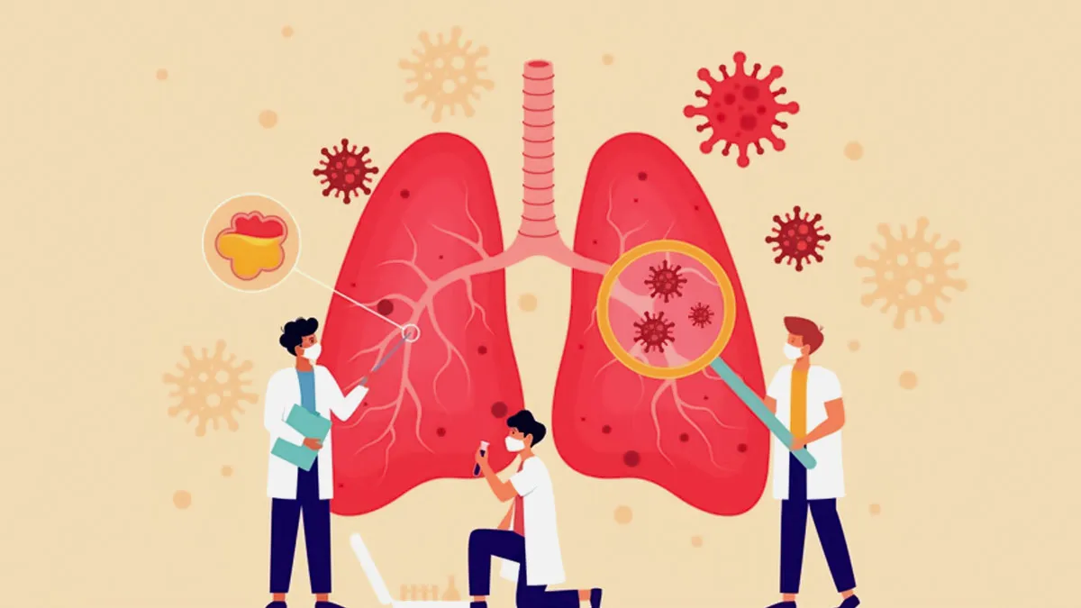 TB vs. Pulmonary Fibrosis: Doctor Explains the Key Differences