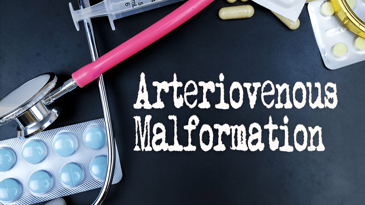 Arteriovenous-Malformation