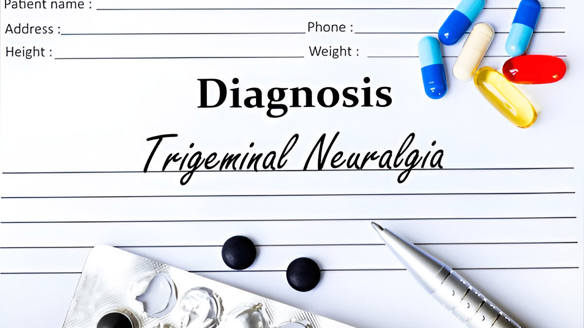 Trigeminal-Neuralgia