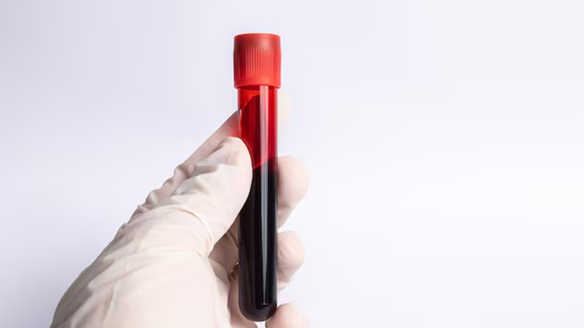 Gwada Negative: Scientists Identify New Blood Type In Guadeloupe Woman - All You Need To Know